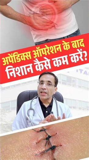 Appendix Scar Removal Tips | Surgery Marks Kaise Kam Hote Hain?