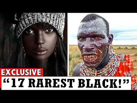 17 Rare Genetic Traits Found in Black People You Won’t Believe Exist 😳
