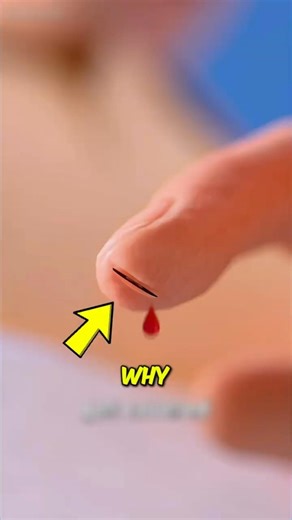 Why Do Paper Cuts Hurt More Than Bigger Wound? 😳 #shorts
