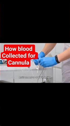 Blood Collection from a Cannula: A Step-by-Step Guide #foryou #nursingeducation #nurselife