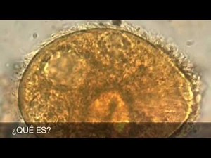 Balantidium coli