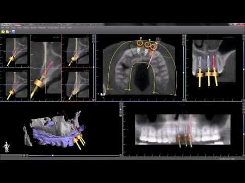 Modes - Blue Sky Plan Tutorial