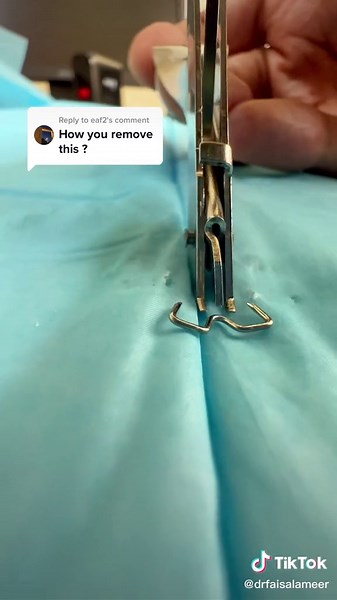 How to Remove Skin Staplers: Step-by-Step Guide