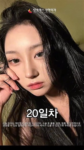 탑클래스성형외과 on Instagram: "눈코수술 후 3초 카리나⁉️⁉😍😍 #탑클래스성형외과 #눈코맛집 ✅️ 수술 결과는 개인에 따라 차이가 있을 수 있습니다. ✅️ 성형 관련 문의사항은 dm 주시면 안내 도와드리겠습니다.🙂 ✅️ 출연자에 대한 비방, 욕설은 무통보 삭제 처리 됩니다. 💻홈페이지 www.topps.co.kr 💃 모델모집 https://topps.co.kr/htm/model_apply.php 📞전화상담 02-567-3456 📺YOUTUBE 탑클래스성형외과"