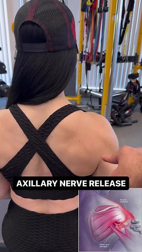 ⚡️What does Axillary nerve pain feel Iike? ⚡️ 🤔 Experiencing weakness when lifting your arm or discomfort around your shoulder? Do you feel like something is limiting your ability to raise your arm or rotate it smoothly? You might be dealing with an irritated or compressed axillary nerve. 📚 Anatomy & Function: The axillary nerve originates from the C5 and C6 nerve roots of the brachial plexus, traveling through the quadrilateral space and wrapping around the shoulder to innervate the deltoid a