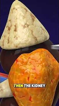 Nephrectomy Surgery-3D Animation