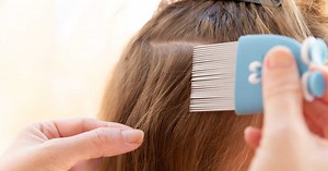 Traitement des poux chez les enfants : l’Anses alerte sur les dangers du mésusage d’antiparasitaires pour animaux