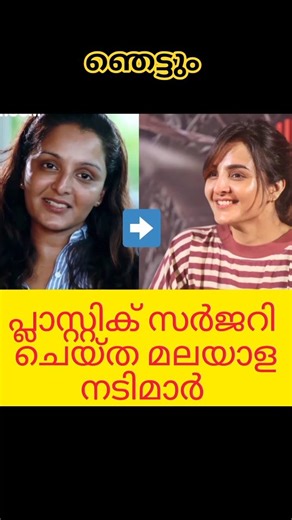 പ്ലാസ്റ്റിക് സർജറി ചെയ്ത മലയാള നടിമാർ