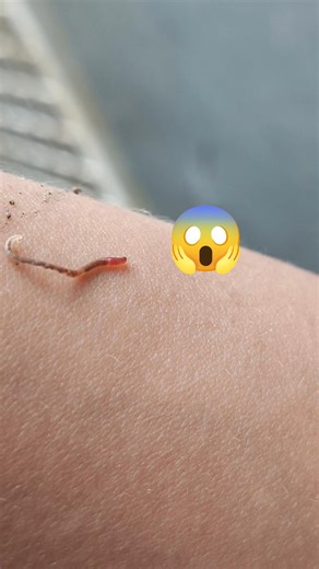 I found this crawling on my arm while gardening