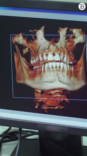 Types of teeth and their functions: Why do they have different shapes?