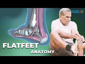 Flat Feet. Critical Exercises for Pronated FlatFeet | Causing Foot & Leg Pain | Best Treatments