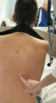 lungs examination #palpation #auscultation #percussion #doctor #hospital #baby #life