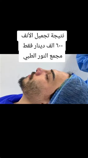 ‏#تجميل_الأنف #دكتورة_نور_امين #مجمع_النور_الطبي #برنامج_الصحة_والجمال