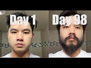 I Grew Out My Beard For 3 Months Using Minoxidil (Rogaine)