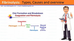 Fibrinolysis | Lab Tests Guide