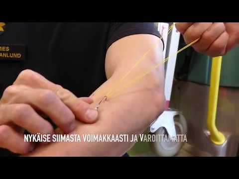 Koukun poiso ihosta