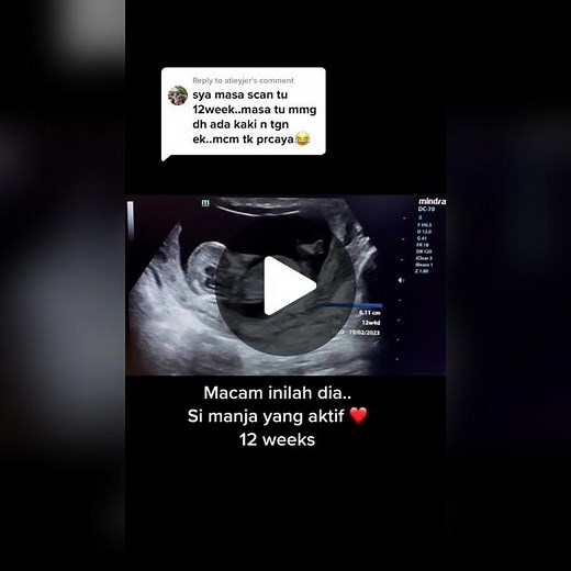 12 Weeks Pregnancy: Baby Development & Symptoms Explained