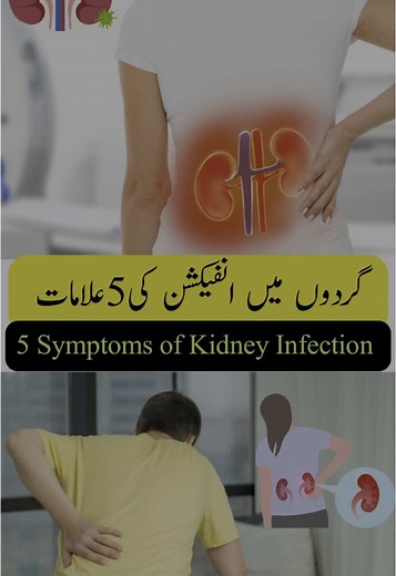 Understanding Kidney Infection Symptoms