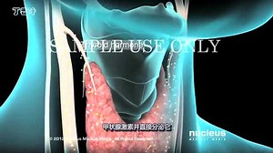 甲状腺手术（甲状腺切除术）