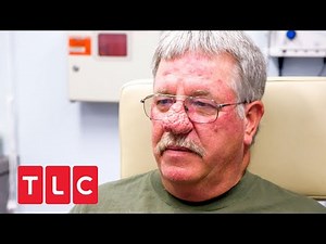 Patricks leben ist eine Qual... | Dr. Pimple Popper | TLC Deutschland