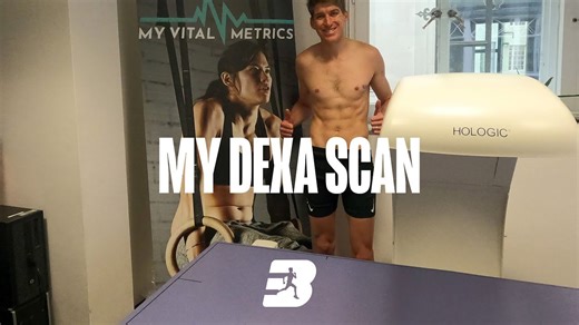 My Dexa Scan Results and Experience