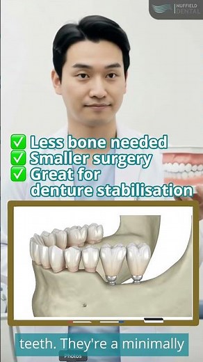 Mini Dental Implants