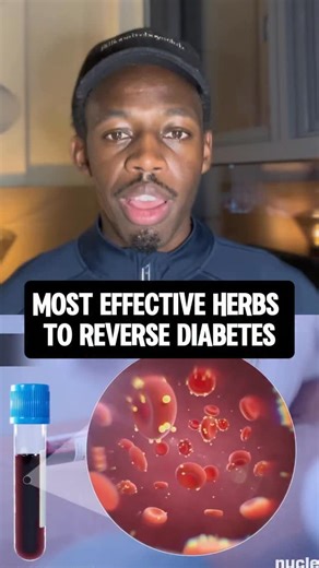 If you want my full Diabetes guide, message ‘REVERSE’ and I’ll send it over When you understand what causes diabetes, it gives you the roadmap to healing it 🗒️ Fundamentally it is a liver issue not a pancreas issue so by supporting the liver we can reverse the true underlying cause. The guide breaks down exactly what you need to do to bring your A1C levels down back to normal #insulin #diabetes #bloodsugar #sugarcravings | MagicTree Superfoods