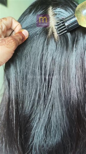 Hair growth serum 😳🤔 #tamilstatus #meesho#youtubeshorts #ytshort #ytshortsindia#ytshorts #ytviral
