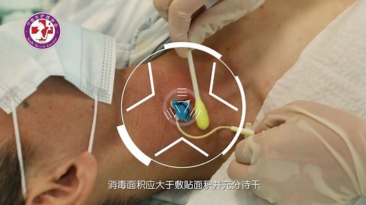 留置针、PICC、CVC、PORT的这些区别你了解了吗？