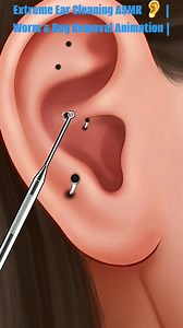 Extreme Ear Cleaning ASMR 👂 | Worm & Bug Removal Animation | #reels #trending #cleaning #satisfying #3danimation | Akhilesh Yadav