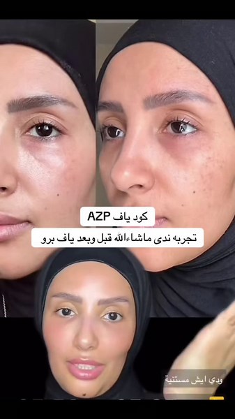 تجربتي مع ياف برو للعناية بالبشرة