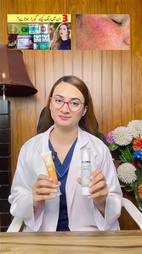 When skin is affected by steroid overuse, protect it with a gentle moisturizer and SPF | #skincare
