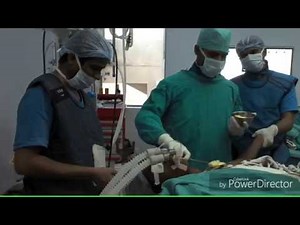 Interscalene block / i-gel insertion