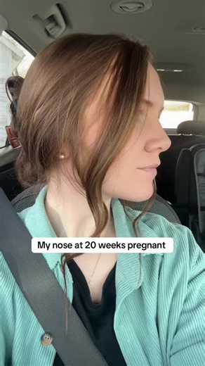 Pregnancy Nose Changes: My Nose at 20–40 Weeks