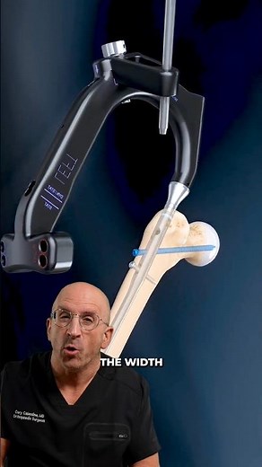 What Happens During Hip Fracture Surgery? A Surgeon Explains