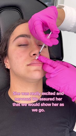 First-Time Lip Fillers Experience in Miami | Beautiful Transformation