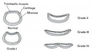 Tracheal Collapse in Dogs - Conquering the Cough