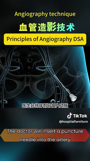 Principles of Digital Subtraction Angiography Explained
