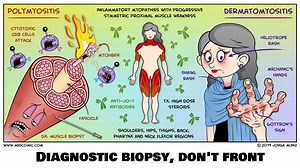 19K views · 130 reactions | The inflammatory myopathies rap video that you never thought you needed is here. Artwork by Jorge Muniz, PA-C, Medcomic. Music by Neil Bobenhouse, DO | KevinMD.com | Facebook