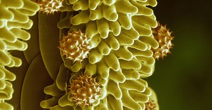 La cryo-microscopie électronique en biologie structurale