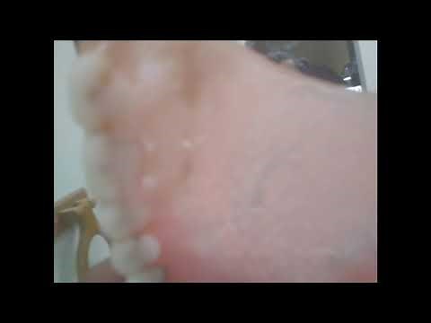 Keeping It Real Dentemp Repair It