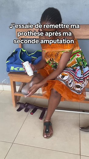 Essayer ma prothèse après amputation