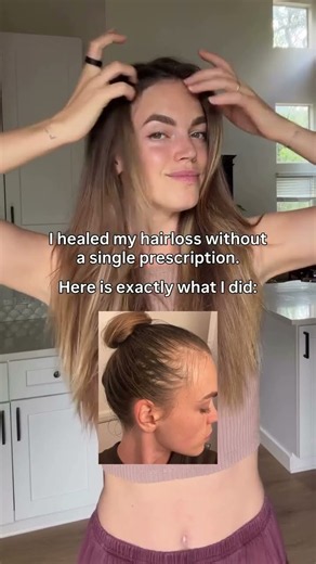 Comment “HEAL” to learn exactly how I got to the root of my hair loss 🤍 After a viral infection,