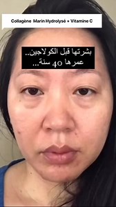 1.7K views | Assist Medical Service on Reels | Facebook