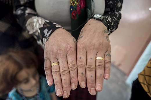 What is gender-based violence, and how can we stop it? | Women for Women International