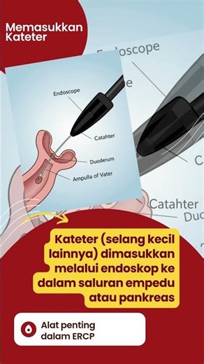 Topik 3 Prosedur ERCP