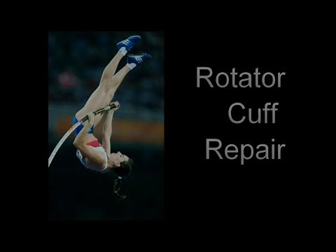 Rotator Cuff Repair - GeorgeMurrellShoulders