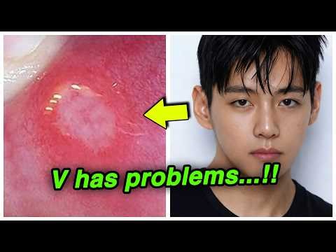 BREAKING: BTS’ V Reveals Medical Condition & Moves Out, RM’s Dramatic Change, J-Hope Responds