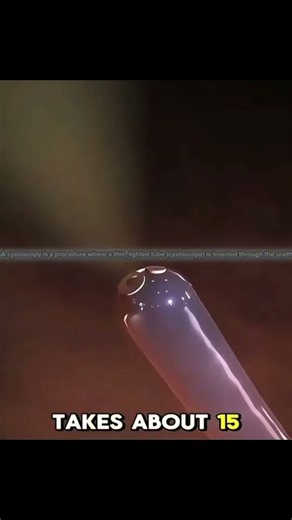 Cystoscopy Procedure Explained | 3D Medical 🩺 #Cystoscopy #BladderHealth #Urethra #MedicalAnimation