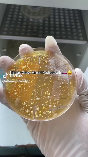 Cultivating Fungi with Sabouraud Dextrose Agar